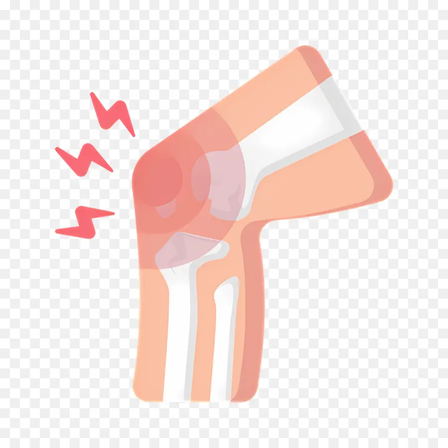 Dolor De Rodilla，Ilustración De Dolor De Rodilla PNG