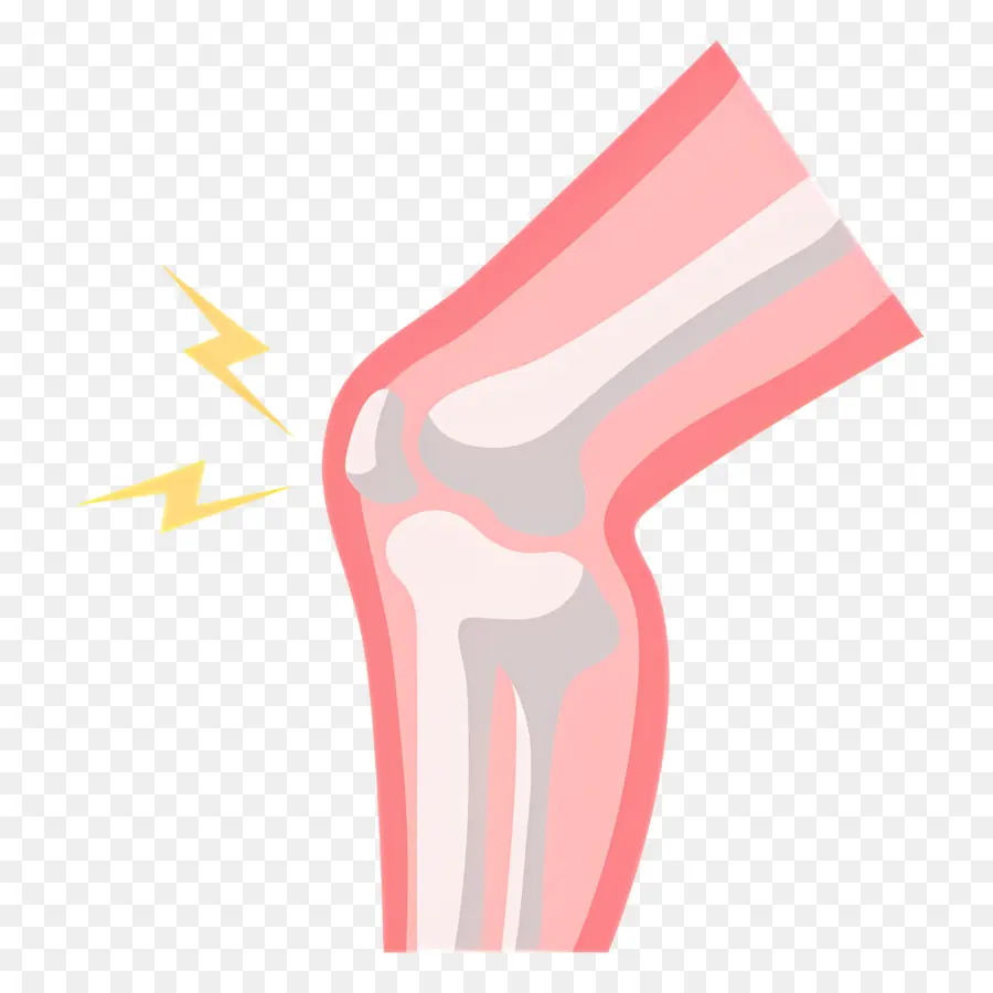 Dolor De Rodilla，Articulación De La Rodilla PNG