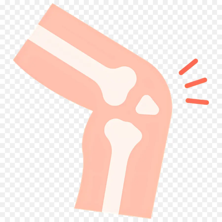 Dolor De Rodilla，Ilustración De La Articulación De La Rodilla PNG