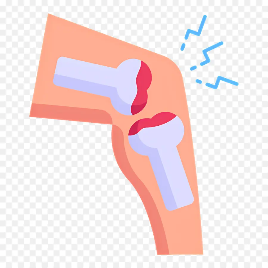 Dolor De Rodilla，Articulación De La Rodilla PNG